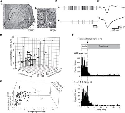 Spike Timing Rigidity Is Maintained in Bursting Neurons under Pentobarbital-Induced Anesthetic Conditions
